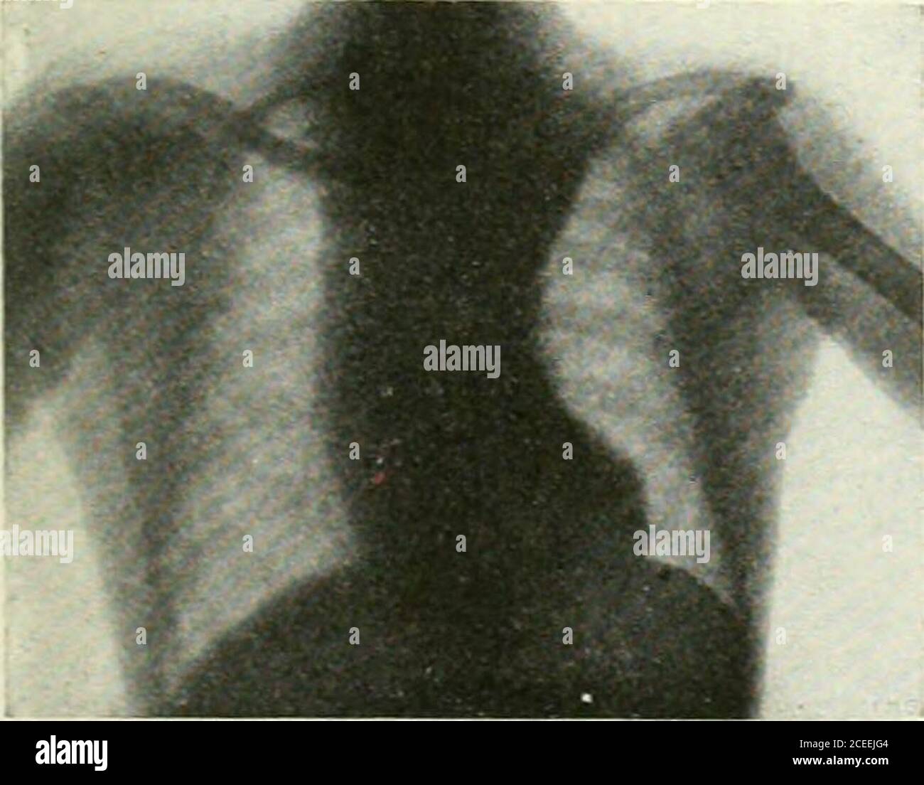 Aktinium hi-res stock photography and images - Alamy