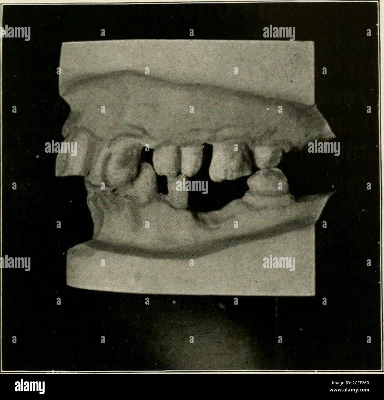 . Oral anaesthesia; local anaesthesia in the oral cavity, technique and