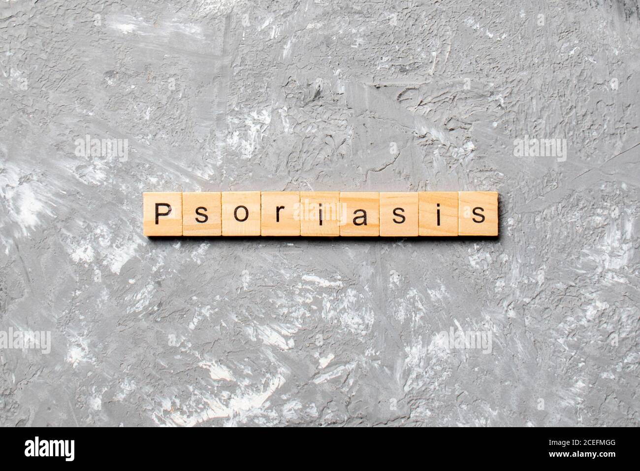 Psoriasis research hi-res stock photography and images - Alamy