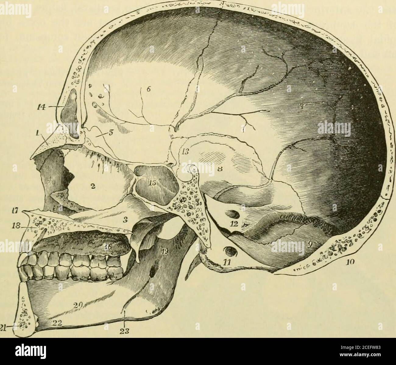 Occipital sinus hires stock photography and images Alamy