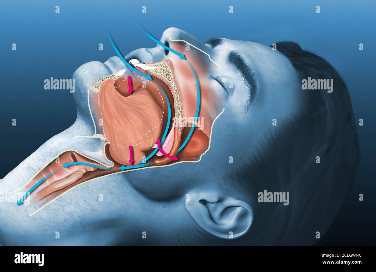 Medically 3D illustration shows a sleeping snoring man Stock Photo