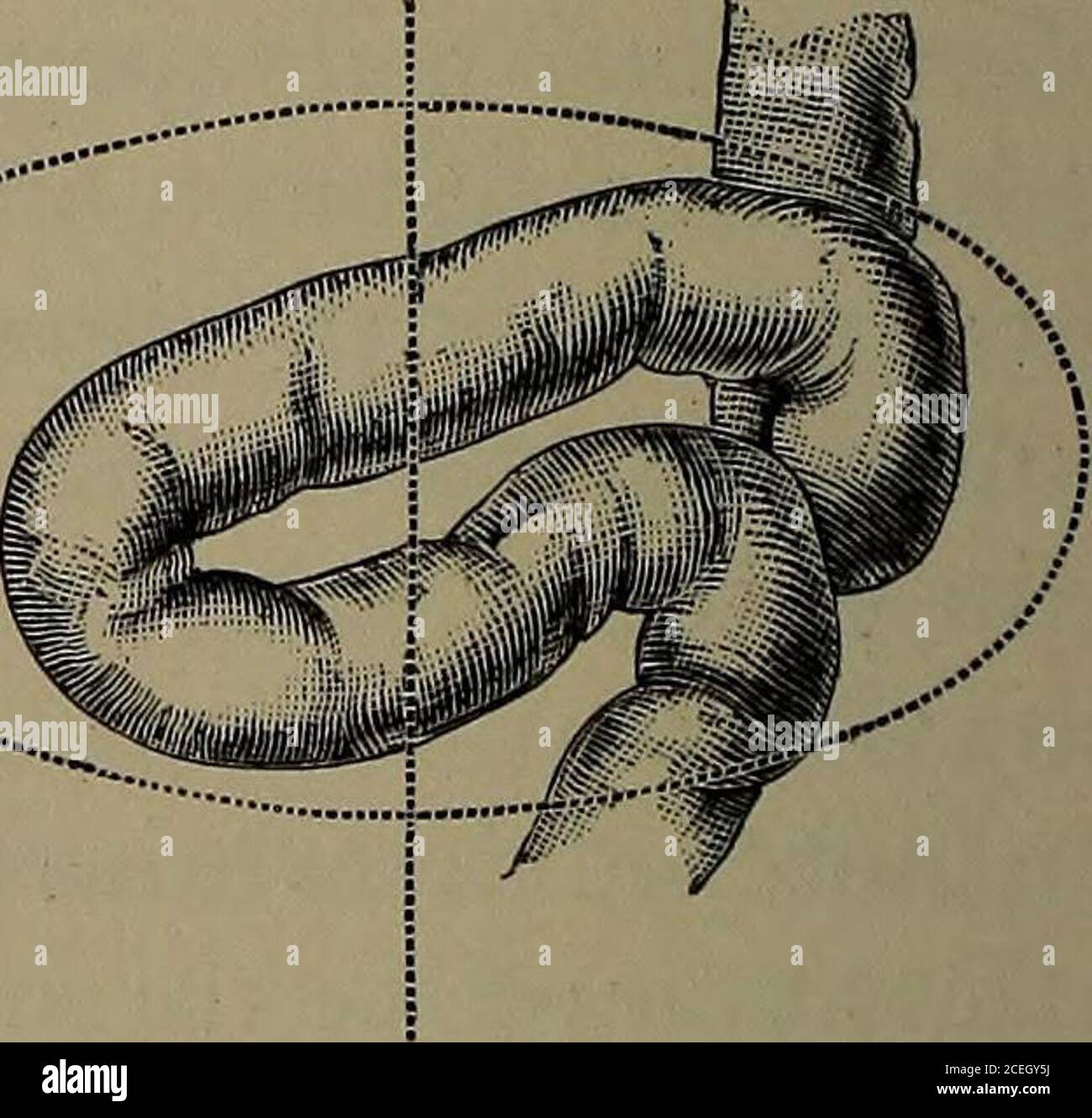 . Medical diseases of infancy and childhood. Semidiagrammatic drawings