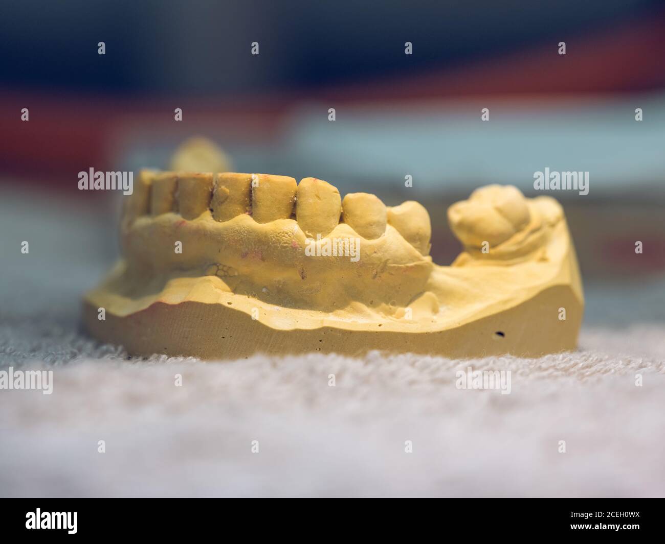 Closeup shot of denture mold lying in modern dental laboratory Stock Photo Alamy