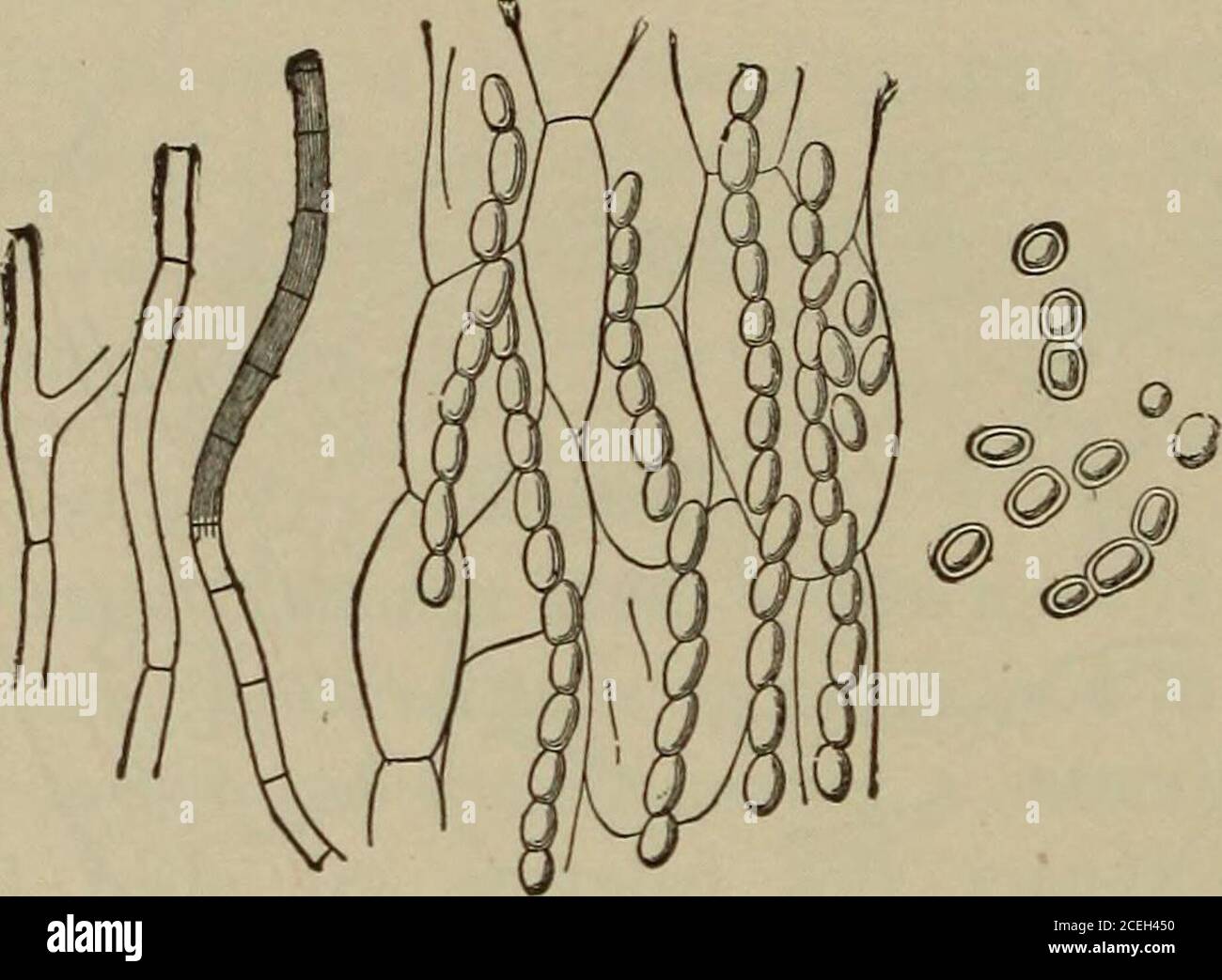 . Essentials of laboratory diagnosis; designed for students and practitioners. idia are en-capsulated or are strung together like the beads of a necklace,and appear as round, oval, angular, or very irregularly con-toured bodies. These mycelial threads branch at right angles;the spores measure from 3 to 10 microns in diameter (Hyde). Trichophyton Megalosporon Endothrix.—This organism isthe cause of tinea circinata (herpes tonsurans, ringworm of the 164 VEGETABLE PARASITES body) and of tinea sycosis (tinea barbae, ringworm of the beard,barbers itch). The trichophyton is composed of spores, which Stock Photo