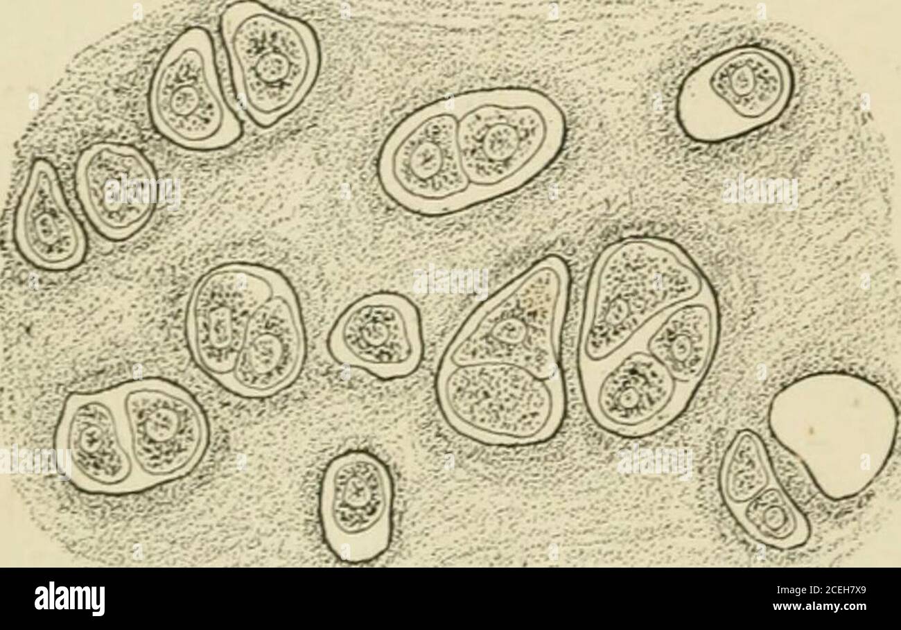 Dense connective tissue hi-res stock photography and images - Alamy