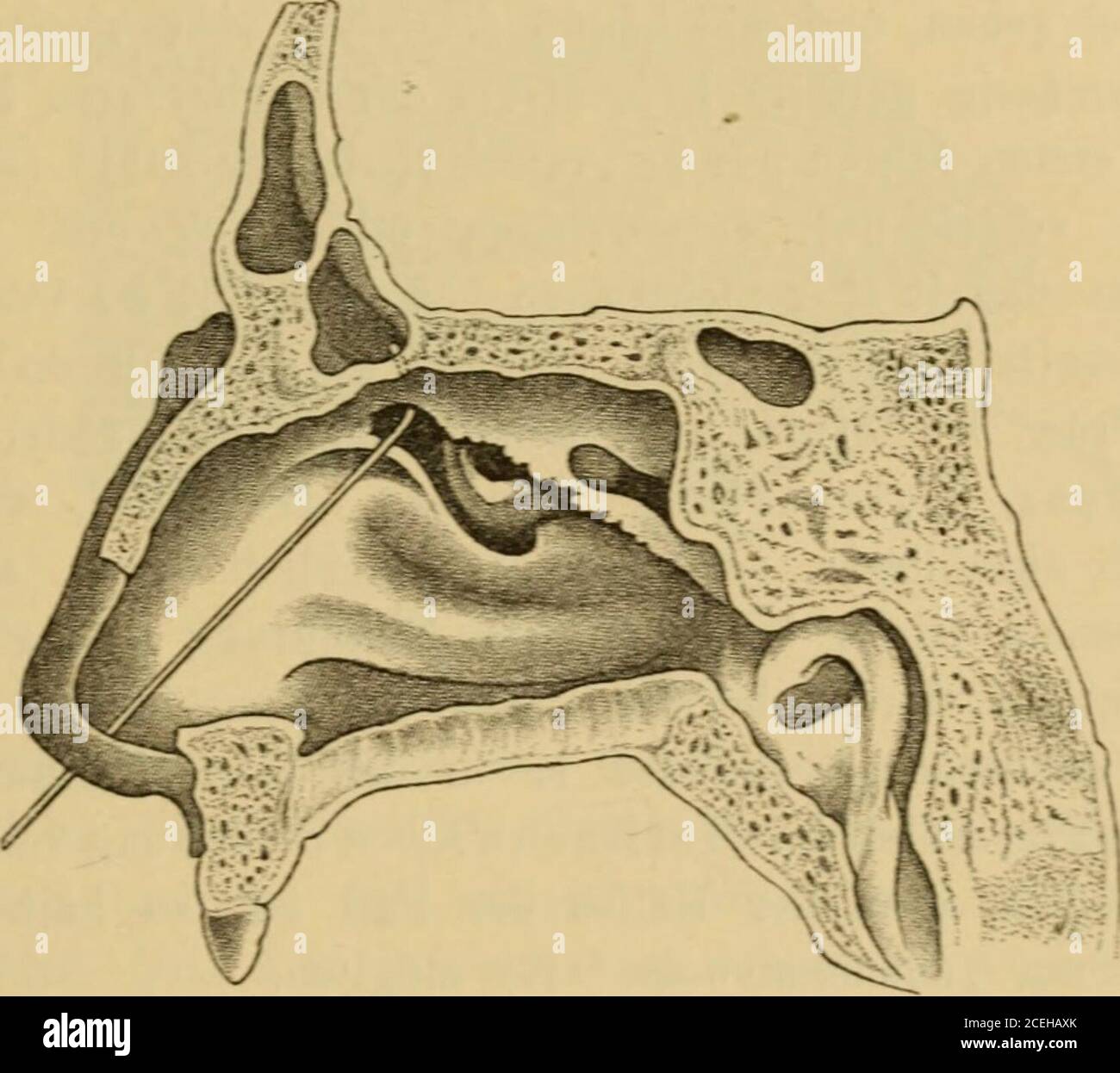 . Handbuch der Laryngologie und Rhinologie ... gte Kichtung zugeben, sondern C hole was 212 Vorschrift zu befolgen: zuerst mitder ganzen Sonde etwas in die Höhe zu gehen und dann erst den Griff Die Untersuchunesmethjden und ihrer Nebenhöhlen. 2±1 zu senken. Derselbe Autor hat im Gegensatz zu Hansberg, welcher,um sieh nicht in die Siebbeinzellen zu verirren, die Sonde mehr nachder Mittellinie dreht, auf anatomische Verhältnisse begründet, seinerle die oben erwähnte mehr lateralwärts gerichtete Krümmung gegeben.Ob die Sondierung wirklich gelungen, oder ob die Sonde nichtdoch in eine der Infundib Stock Photo