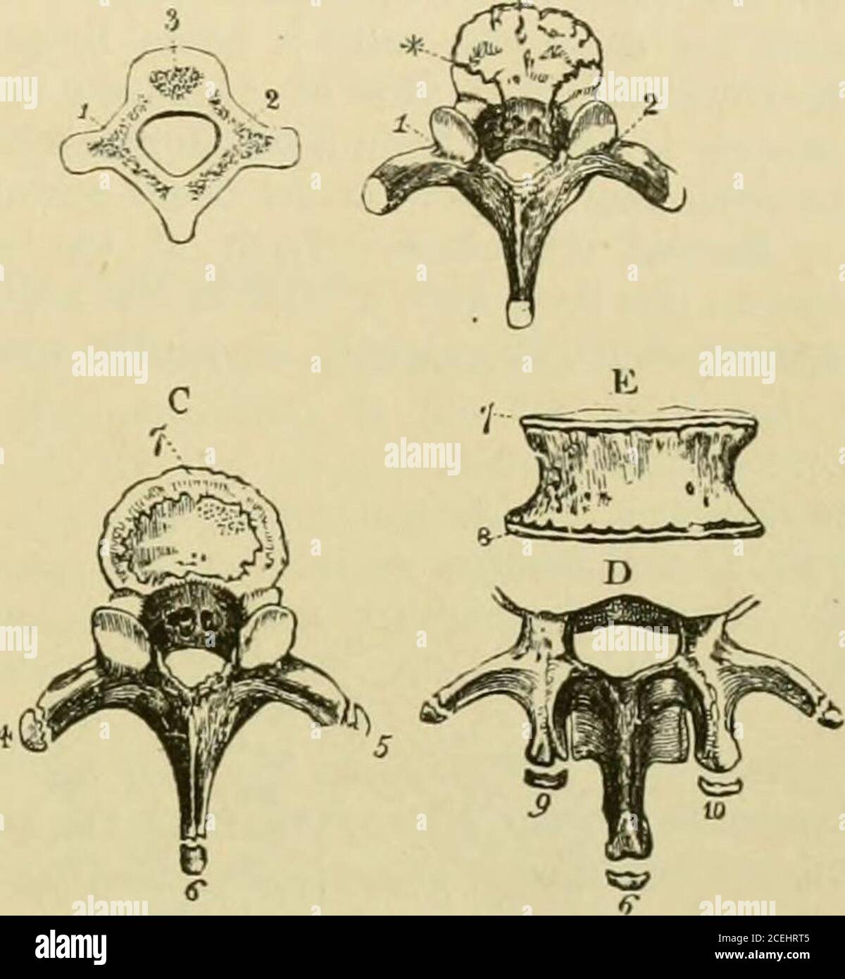 . Quain's Elements of anatomy. responding tothe three original centres. In the first year of infancy the laminas of opposite sides becomeunited in a number of the vertebras, but not in all. The spinous processes, remaining Fig. 19. -Ossification of the vertebrje.(R. Quain.) 1, A, fietal vertebra, showing the three primary centres ;2, neural ossitications ; 3, ceutral ossification. B, dorsal vertebra from a child of two years ; 1 & 2are seen to have encroached upon the body at * theneiiro-central synchondrosis, to have extended into thearticular and transverse processes, and to have unitedbehin Stock Photo