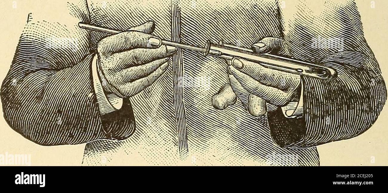 . Pathological technique; a practical manual for workers in pathological histology and bacteriology. tion of a second sterileblood-serum tube, next touched to the infected surface of the FIG. 19—Method of holding tubes dur-ing inoculation. 218 PATHOLOGICAL TECHNIQUE. first tube, and the wire thus infected gently and thoroughlyrubbed over the surface of the second. In a similar mannera third tube is then infected from the second, and then all thetubes placed in the incubator for eighteen to twenty-four hours.It is evident that comparatively few bacteria will be sown onthe medium of the second t Stock Photo