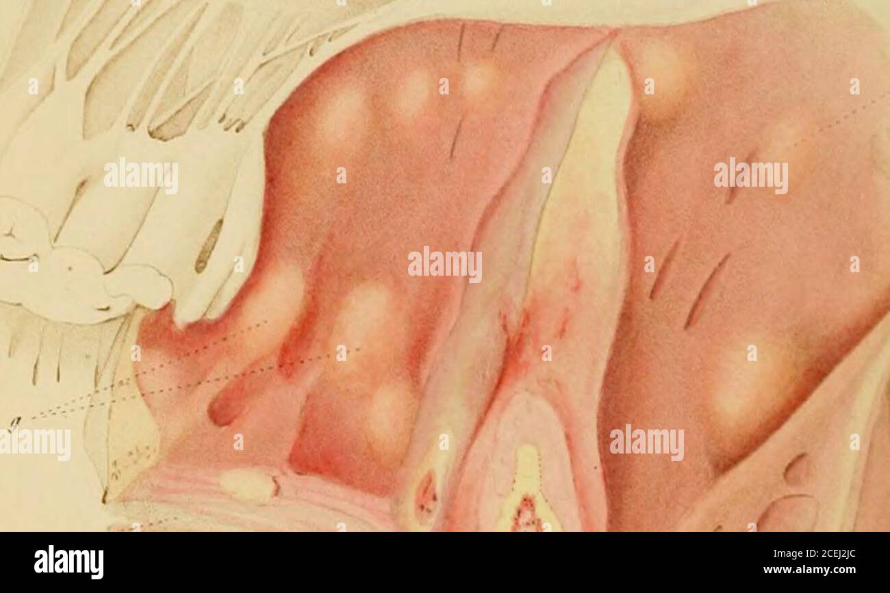 Traite Historique Et Pratique De La Syphilis I I Iq B A Rf N R M I Tl F Gt Uur Lu I Ifiir I F R Lu O O Stock Photo Alamy