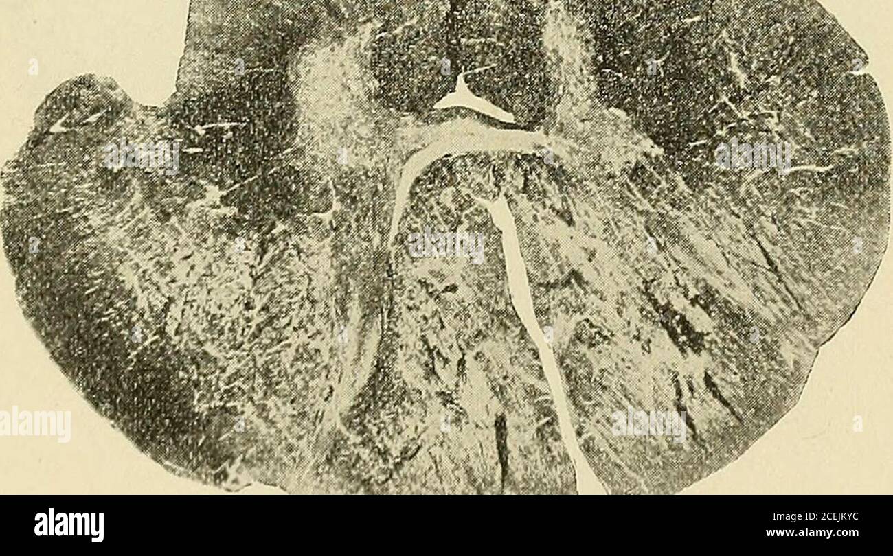 Connective tissue micrograph hi-res stock photography and images - Alamy