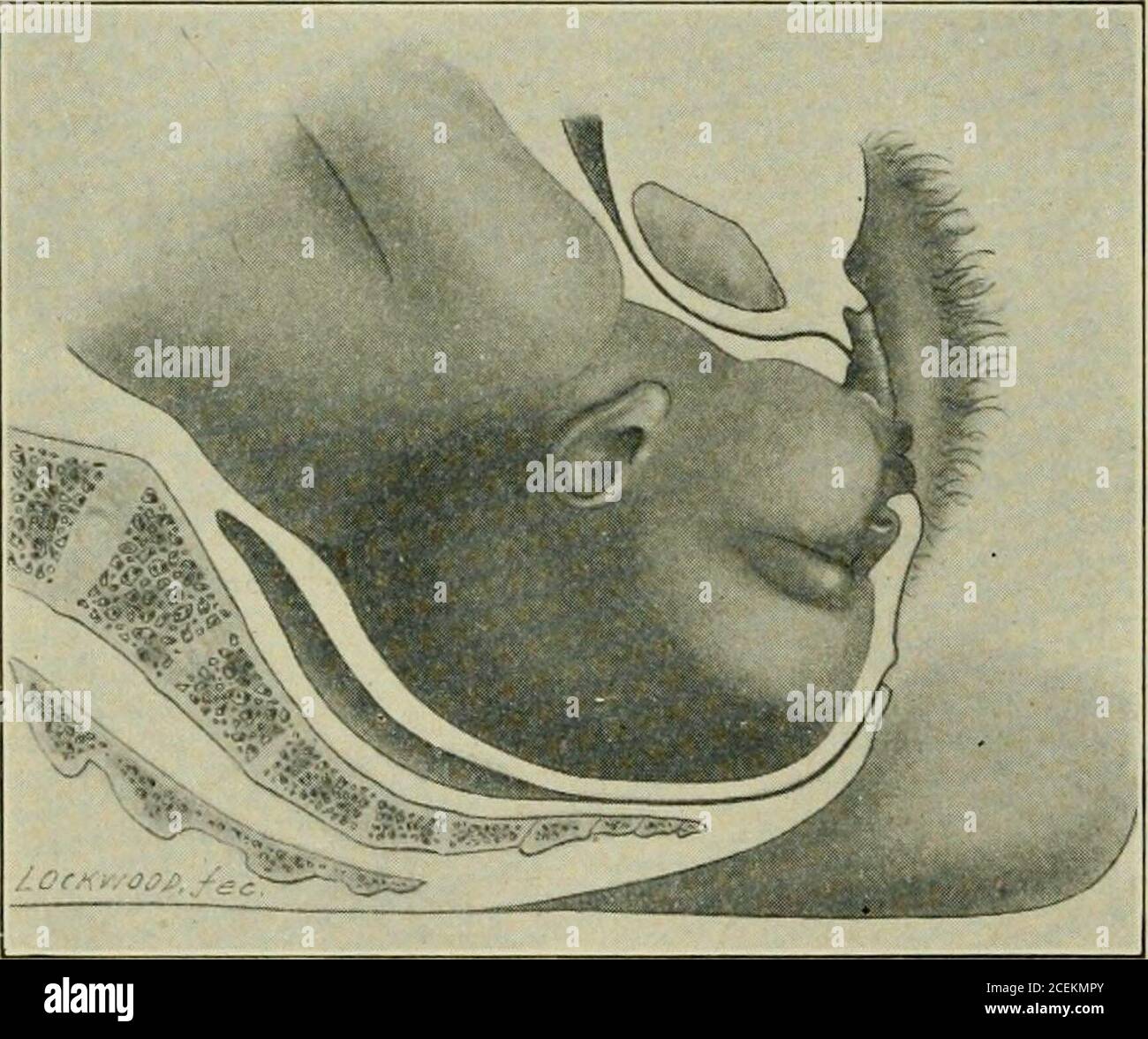 . Obstetrics for nurses. s and the head, so that normal engagement is ...