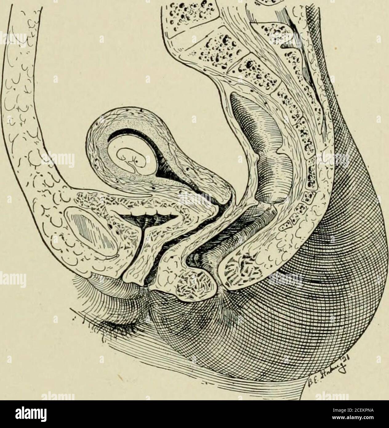Obstetrics for nurses. auses the patientto desire to void atfrequent  intervals.During the fourthmonth, after the fun-dus has ascended intothe  abdominal cavity. Fig. 43.—Six-weeks pregnant uterus with fundus press-,, •  T a