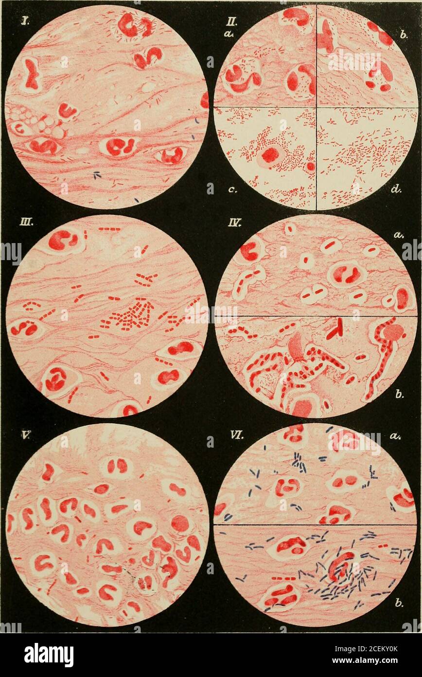 . The bacteriology of the eye. i, either single or in pairs; sometimes in chains, the doubleform being not nearly so regular as in the case of the Diplobacilli. Thecapsules are also much more apparent, and in places—as, for instance, in 1V.6,where the preparation is overstained—they stain light red, and are surroundedby a clear space. In the middle of IV.5 the capsules are overstained, andresemble very large bacilli. (Preparation by Dr. Zur Nedden.) Fig. V.—Bacterium Coli (from a case of blennorrhcea neonatorum). Gram-negative bacilli of varying shape and size. Quite short, and also long,bacil Stock Photo