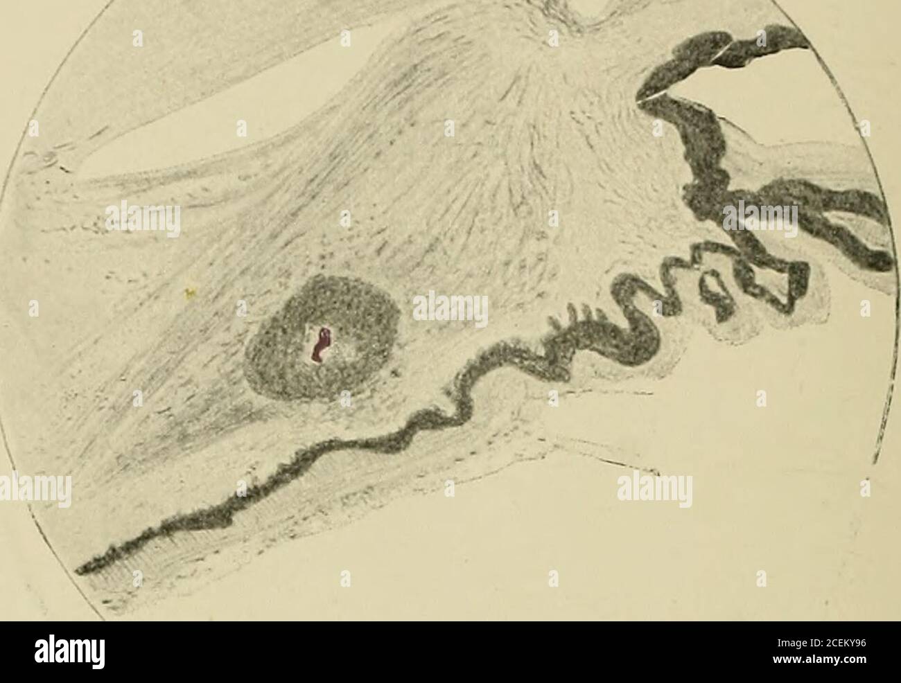 Streptococcal infections hires stock photography and images Alamy