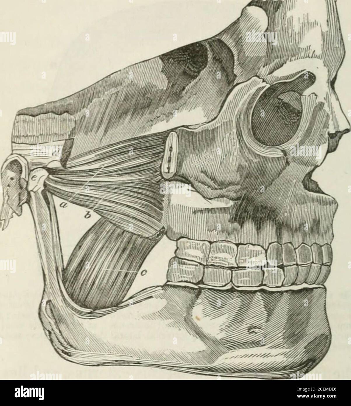 . The principles and practice of dental surgery. nferioredge of the malar bone and the zygomatic arch as far back asthe glenoid cavity ; and is inserted, tendinous and fleshy, intothe external side of the ramus of the jaw and its angle as far upas the coronoid process. The use of this muscle, when both portions act together, is toclose the jaws; if the anterior acts alone, the jaw is broughtforward, if the posterior, it is drawn backward. Pterygoideus Externus (a and b Fig. 33) arises from theouter surface of the external plate of the pterygoid process ofthe sphenoid bone, from the tuberosity Stock Photo