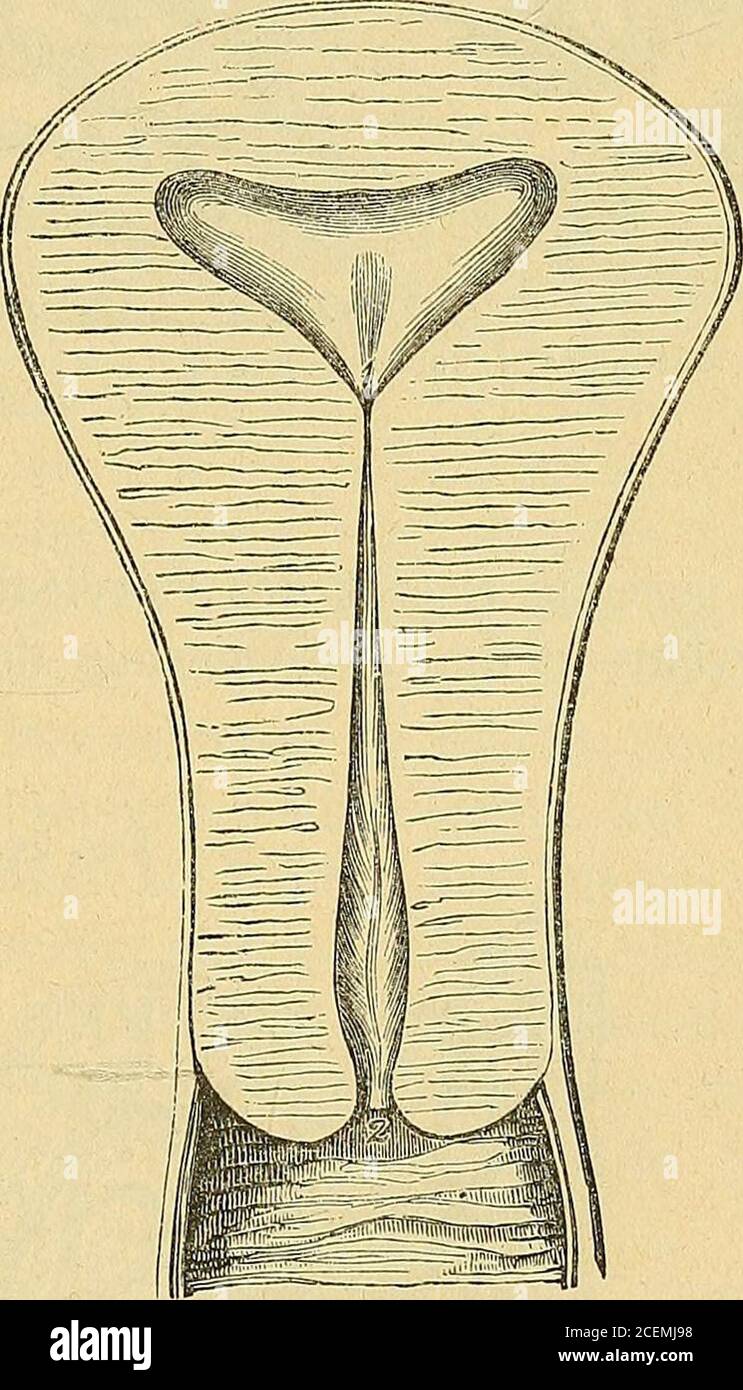 . Lehrbuch der Frauenkrankheiten. Quains Darstellung der Höhleu des Körpersuud Cervix. Bennets Darstellung der Uterus- undCervixuöhlen. Zwischen diesen Falten erblickt man zahlreiche Schleimdrüsen,welche die ]S^aboth,sehen Drüsen heissen. Tyler Smith**) schätzt diein einem gut entwickelten jungfräulichen Cervix enthaltenen Drüsenauf mindestens Zehntausend. Die Schleimhaut, welche diese Faltenoder Rugae bildet, ist mit Cylinder- oder Flimmerepithel bedeckt, und *) Theophilus, Comm. zu Hippocrates, Aph. IL p. 469, Ed. Dietz.**) On. Leukorrhoee, Am ed, p, 38. Thomas, Frauenkrankheiten- ^g 194 Chr Stock Photo