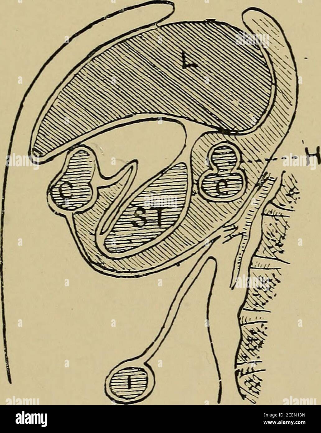 . On retro-peritoneal hernia : being the 'Arris and Gale' lectures on the 'The anatomy and surgery of the peritoneal fossae' : delivered at the Royal College of Surgeons of England in 1897. of a hepatic flexure. Therewas a considerable degree of peritonitis in the epigastric area,and a few fresh adhesions united the ascending colon to theliver. The liver showed no morbid change of any kind.The stomach was merely distended. All the other viscerawere perfectly normal. It was evident that the caecum was undescended, and had led the way through the foramen. HERNIA INTO THE FORAMEN OF WIN SLOW 155 Stock Photo