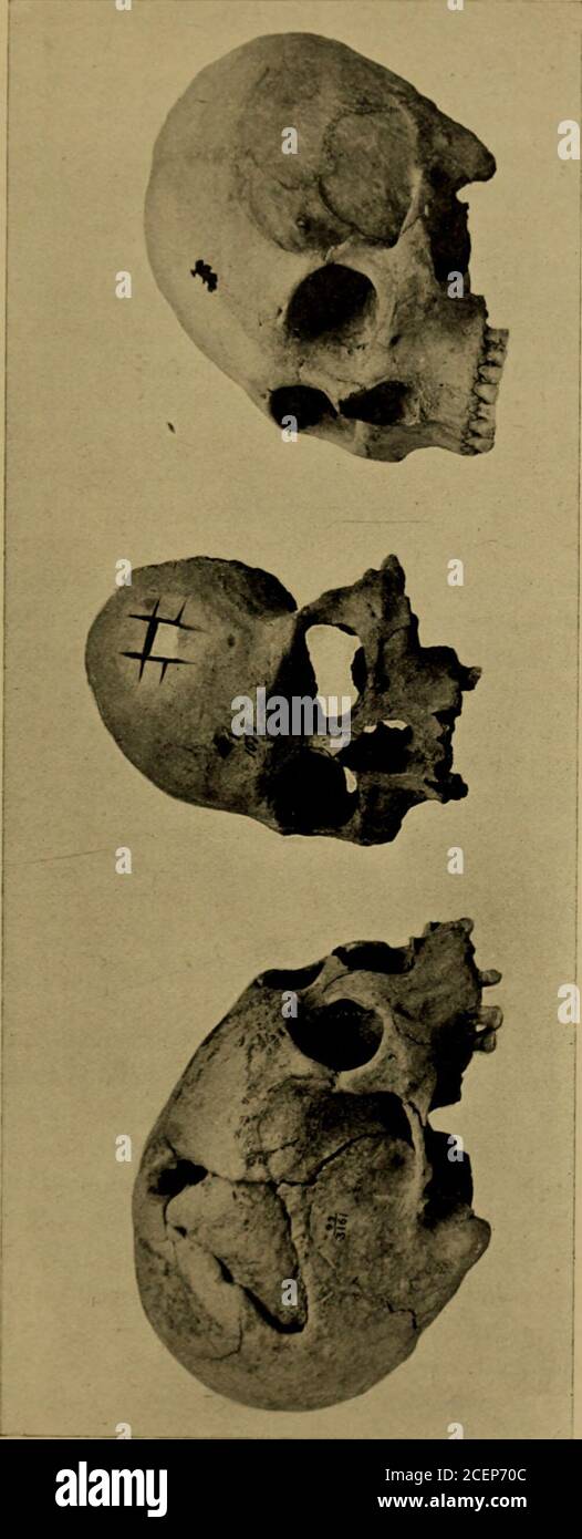 Guide Leaflet H This Guide Relates Chiefly To Burials It May Not Be Out Of Place To Call Attention To Some Peculiarities Of Peruvian Skulls The Skulls Of All Races Are