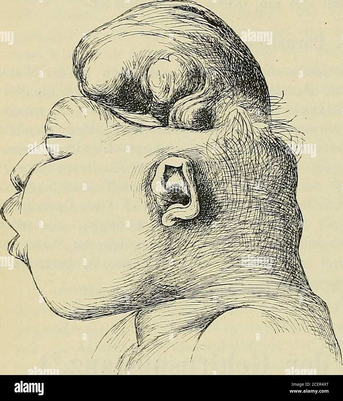 Page 2 Wulst High Resolution Stock Photography And Images Alamy