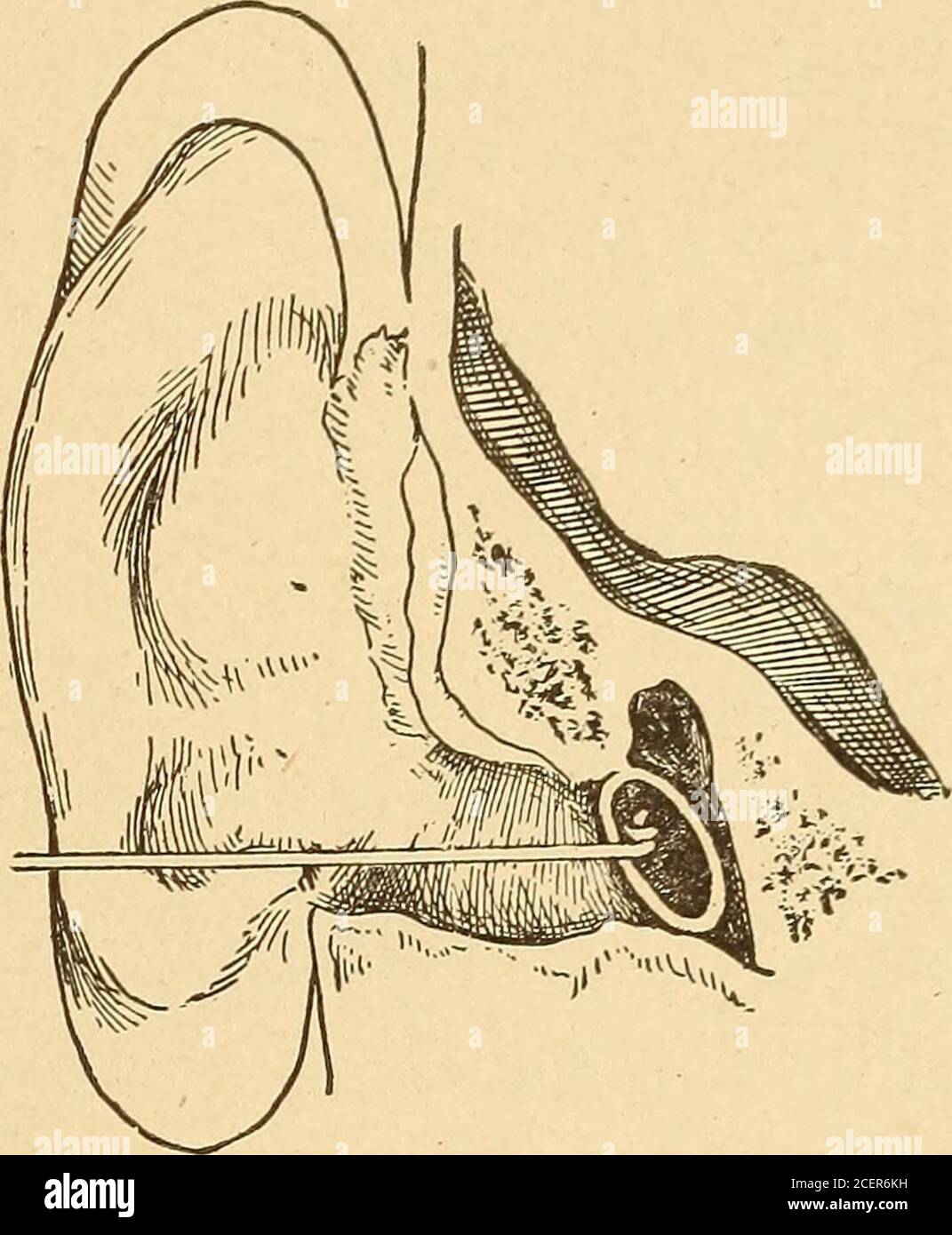 . Diseases of the ear; a text-book for practitioners and students of ...