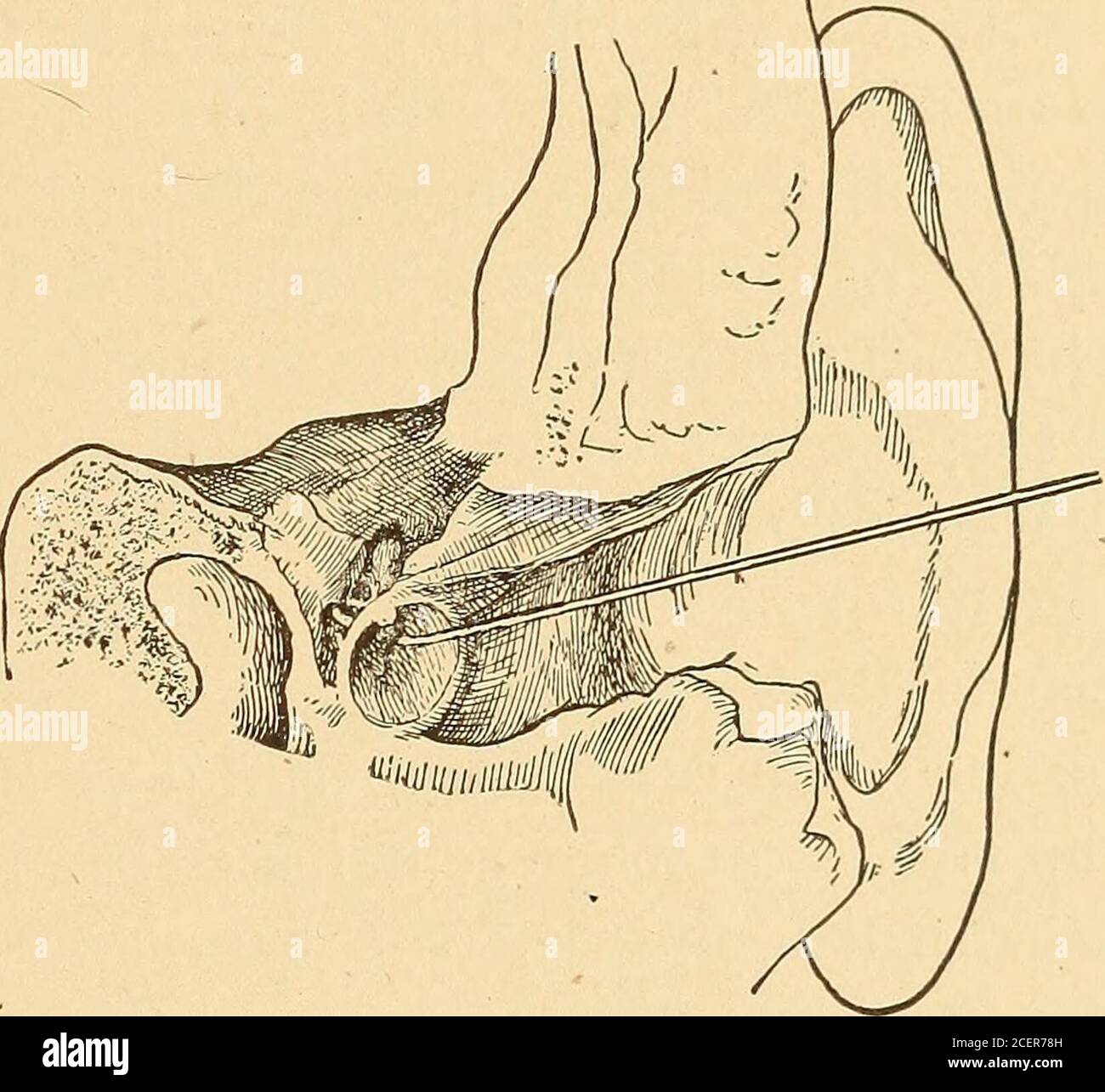 Anterior ligament of malleus hires stock photography and images Alamy