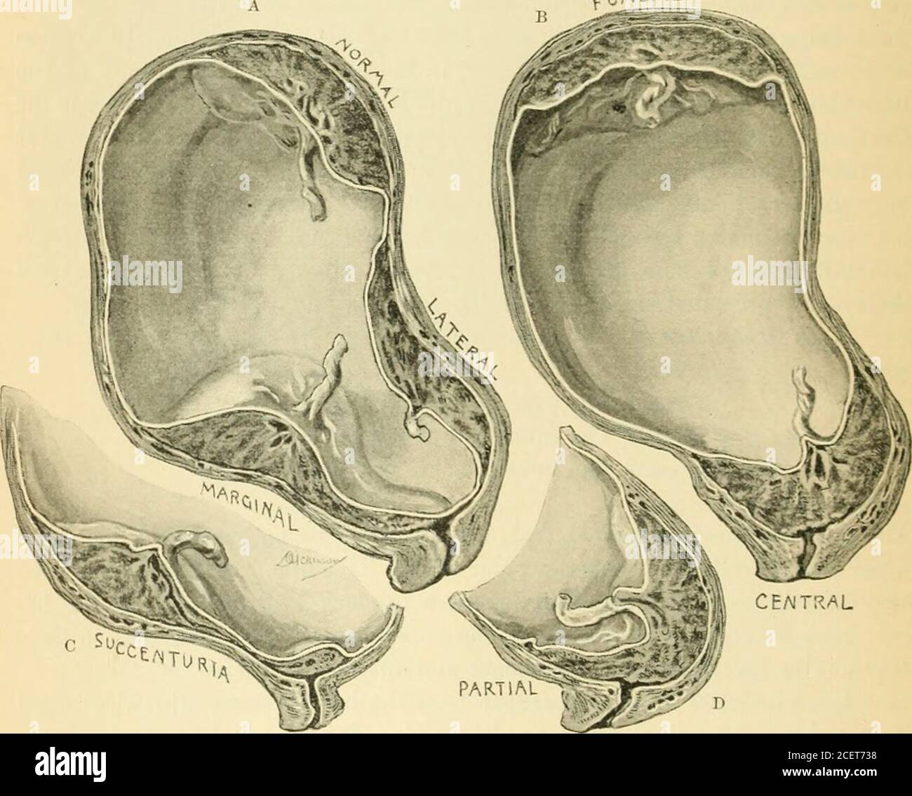 . An American text-book of obstetrics. For practitioners and students ...