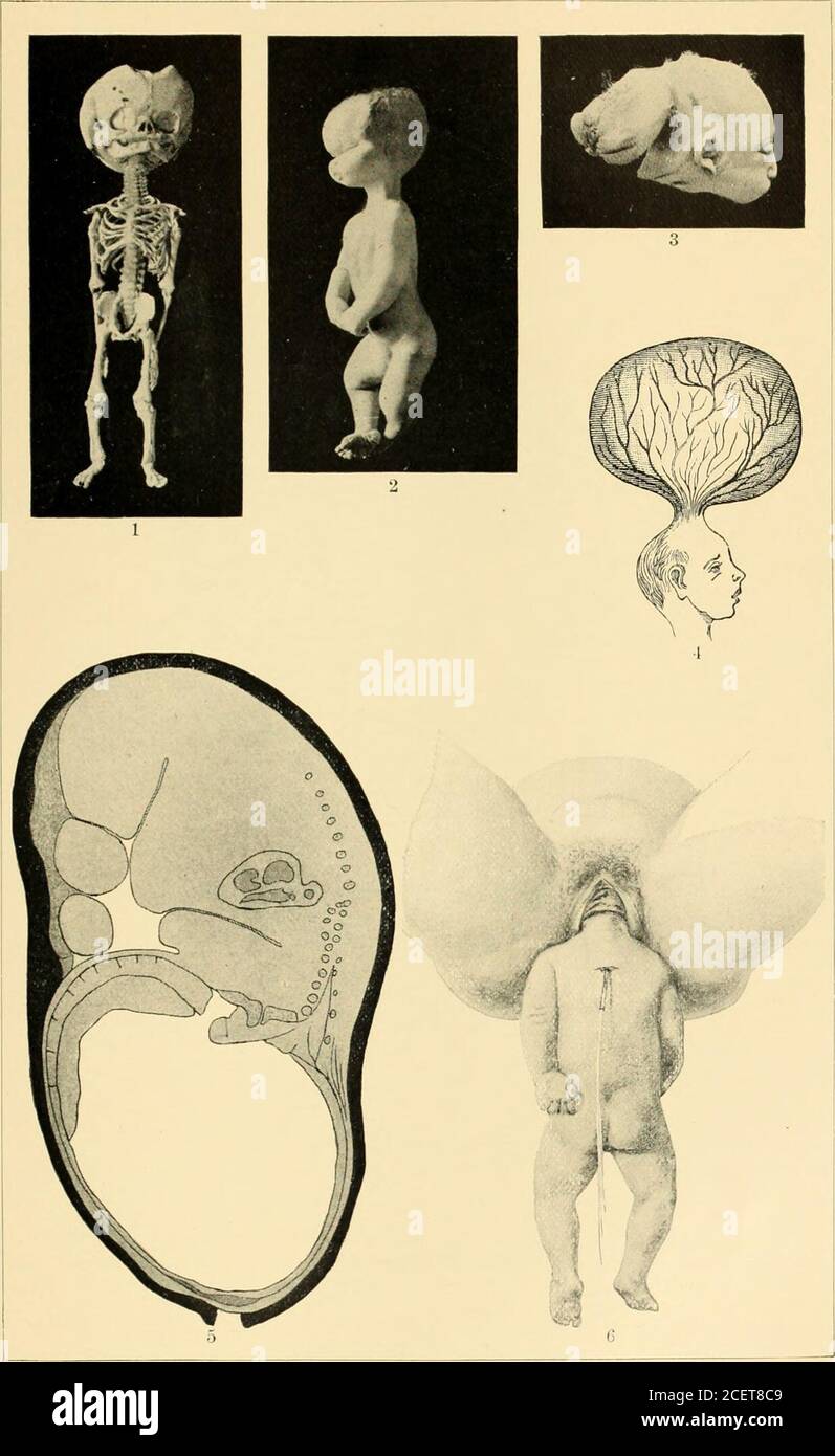 An American Text book Of Obstetrics For Practitioners And Students an-american-text-book-of-obstetrics-for-practitioners-and-students