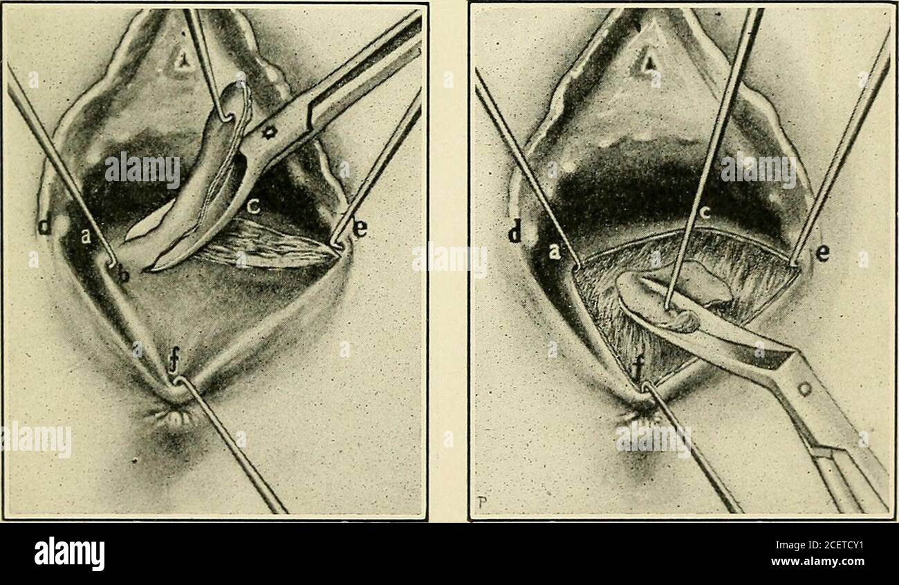 . The Principles and practice of gynecology for students and