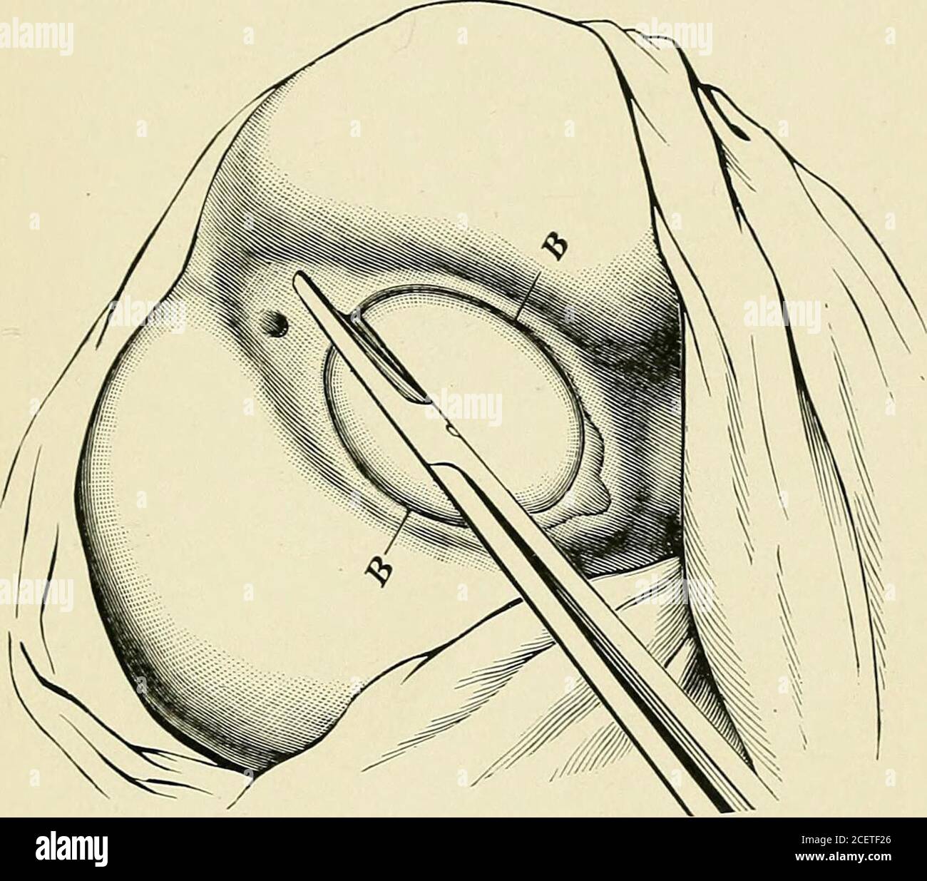 Anatomía del Perineo (Perineum Anatomy): Image Details - NCI Visuals Online