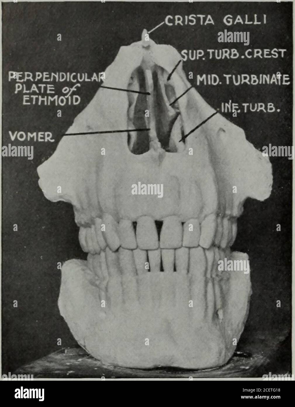 . The Dental cosmos. ess-fully get an accurate mental picture ofthe value, position, and relation of eachbone in the skull. No better way existsof forming a correct picture than con-structing, with our own hands, a modelof the internal face and skull in someplastic material. It should be enlarged National Dental Association, at its annuali t, Va./ July 22, 1913.) on a definite scale, so that we can tracewith our hands the anatomical and. to acertain degree, the physiological func-tions of all the parts. In Fig. 1 are shown, modeled inplaster of Paris, the principal bones ofthe face concerned i Stock Photo