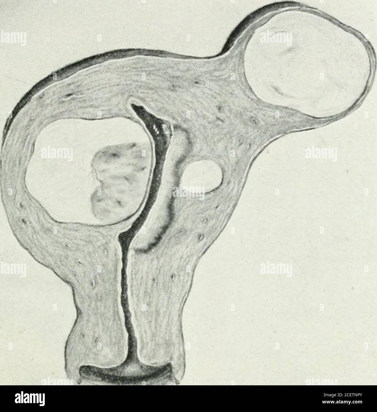 . American journal of obstetrics and gynecology. he uterus for twenty ...