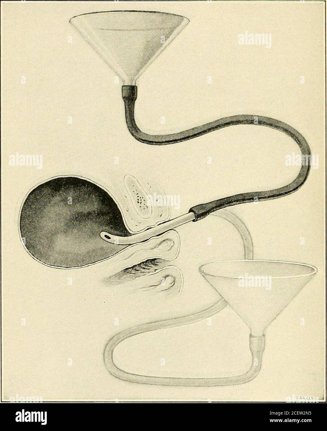 . The Principles and practice of gynecology : for students and practitioners. dtime, and follow^ed if necessary by theopium or morphine suppositories at bedtime. The bowels should be kept normally free by mild laxatives.Drastic cathartics should be avoided. Uva ursi, triticum repens, thebenzoate salts, buchu, eucalyptus, and many other time-honored andclassical remedies may be useful. Urotropin appears to be the mostvaluable single internal remedy. It maybe given in amounts varyingfrom 15 to 30 grains daily. The writer occasionally has been gratified 328 INFECTIONS, INFLAMMATIONS, AND ALLIED D Stock Photo
