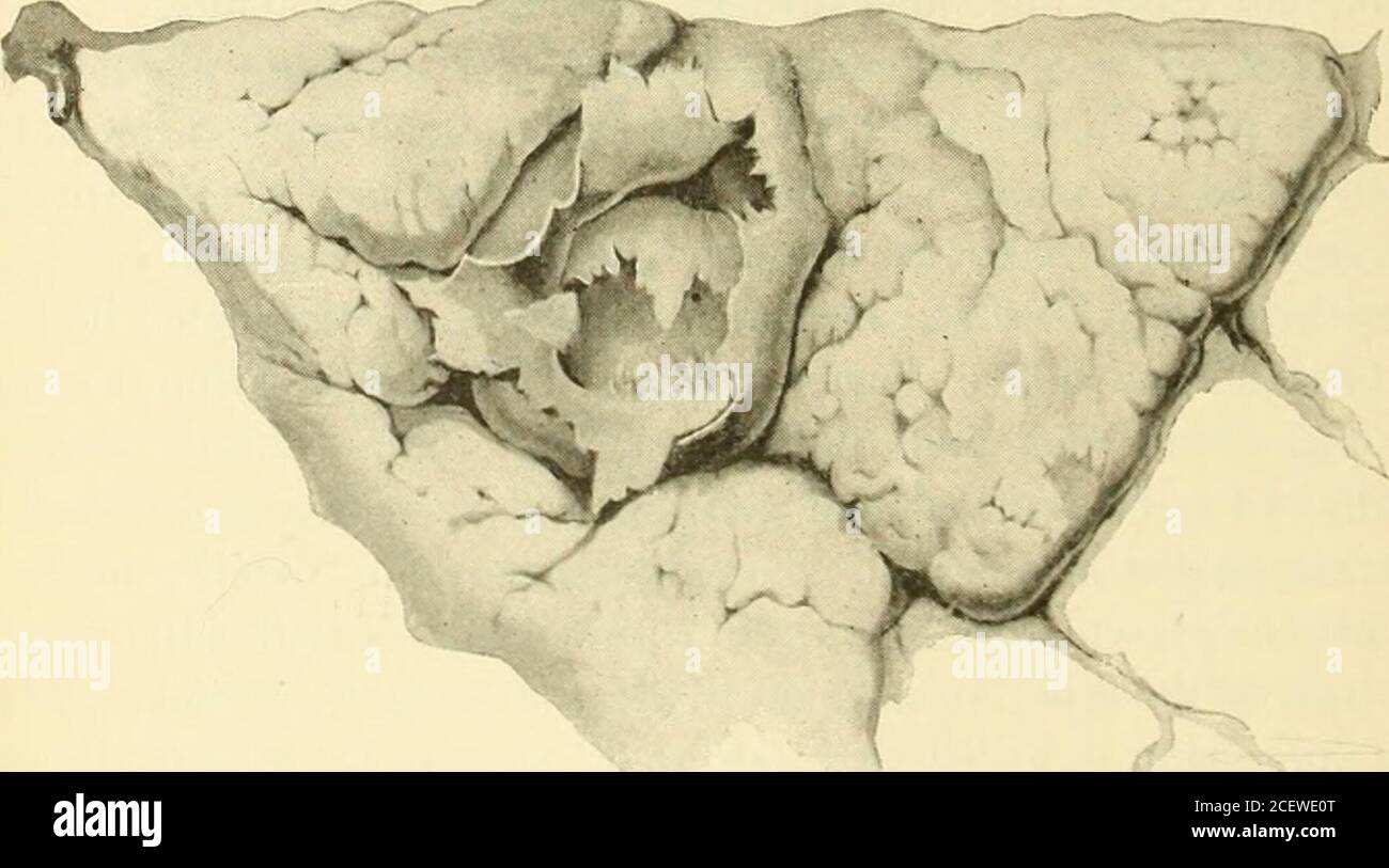 Embryo specimens hi-res stock photography and images - Alamy