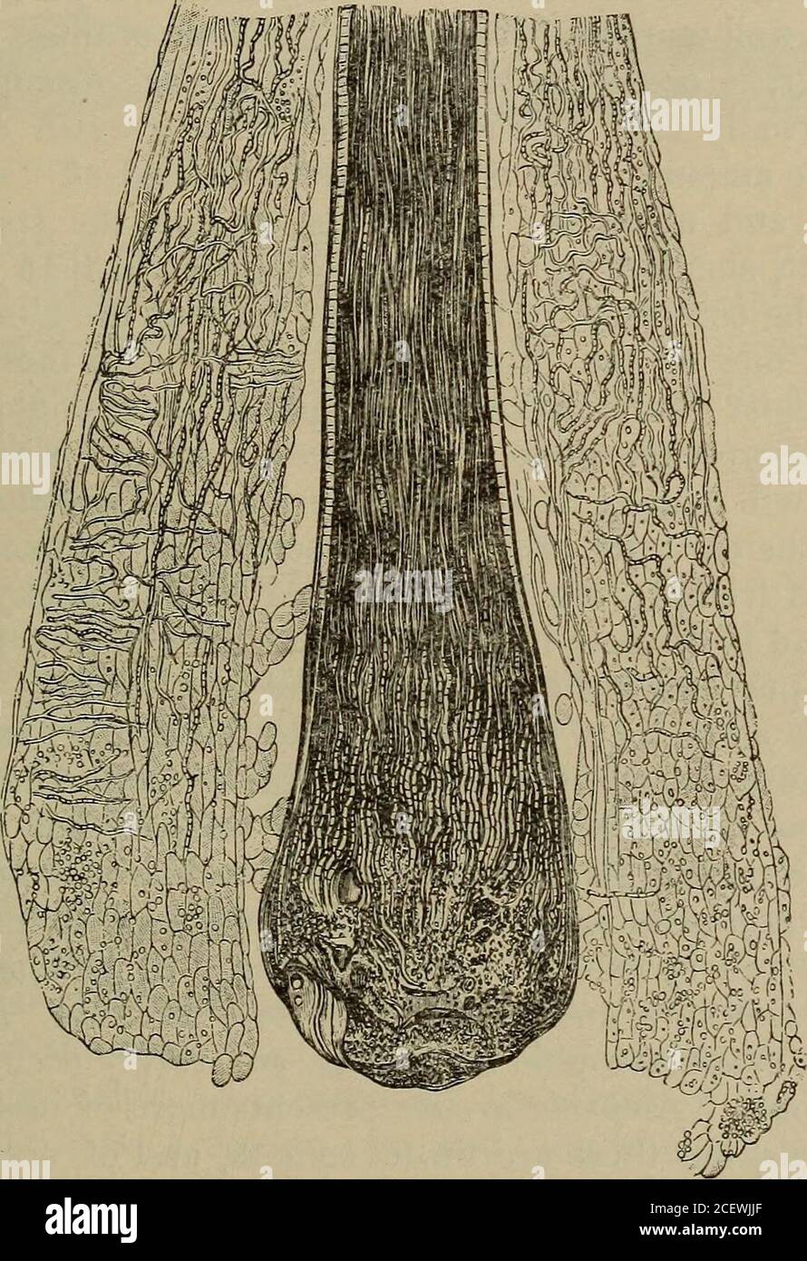 . The ready-reference handbook of diseases of the skin. %Achorlon Schoenleinii. (After Kaposi.) ^ orifices of the hair follicles, and, after remaining there un-disturbed, began to grow in the upper part of the hair sac,and between the superficial layers of the epidermis, andsubsequently invade the hair, growing in its cortical sub-stance. The cup may be formed either by the sinking in ofthe more central portion of the mass, or on account of thecentral portion being attached to the hair so firmly that itcannot so readily give way and bow out under the pressureof the growing fungus as do the par Stock Photo
