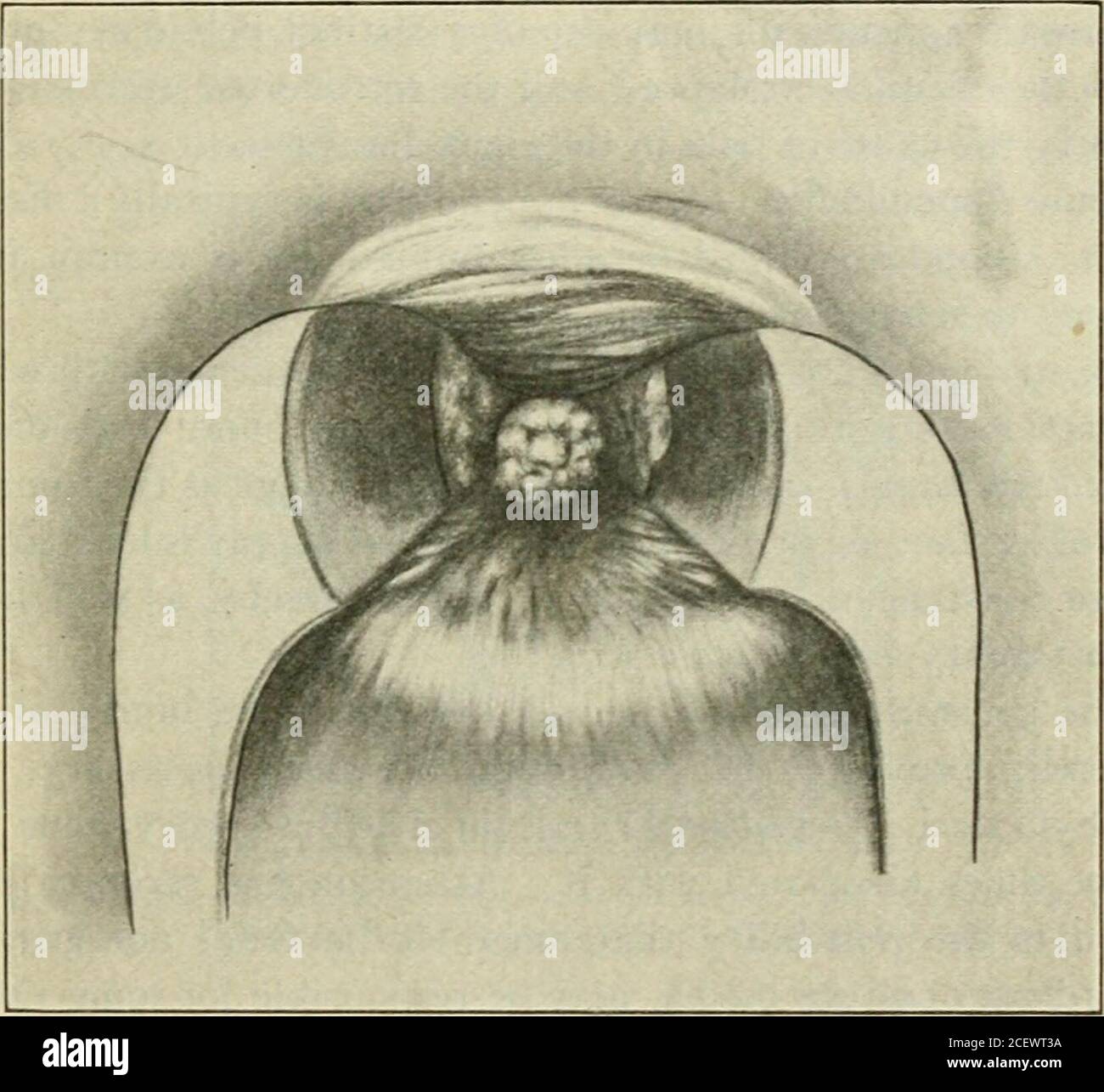 . A manual of gynæcology and pelvic surgery, for students and