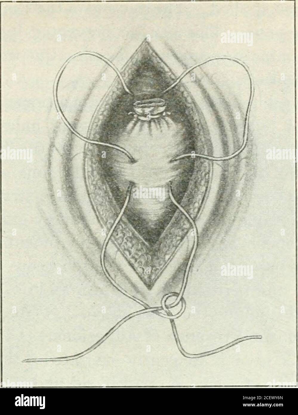 Obstetrical Etiologies of Abdominal Pain | Abdominal Key