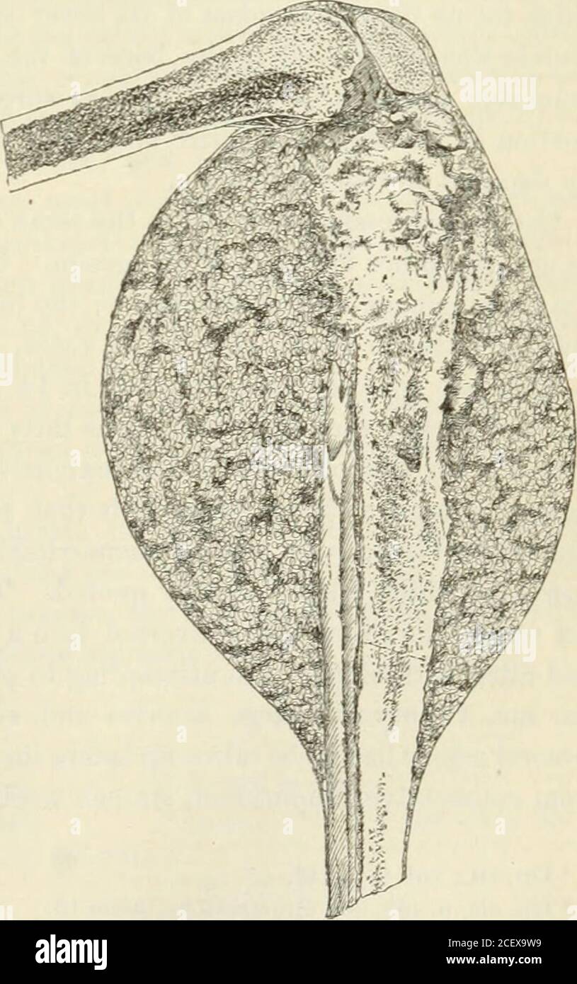 The American Journal Of The Medical Sciences Short Osteophytic Vegetations Which Are Inseparably Connected With The Compact Tissue Of The Femur Andrepresent A True Hyperplastic Process Again The Ossified Portion Of Thegrowth