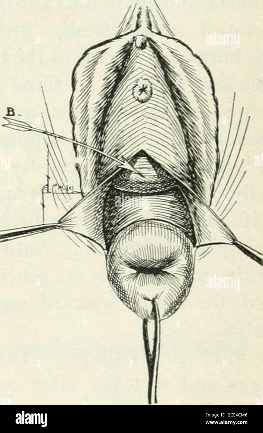 . A manual of gynæcology and pelvic surgery, for students and ...