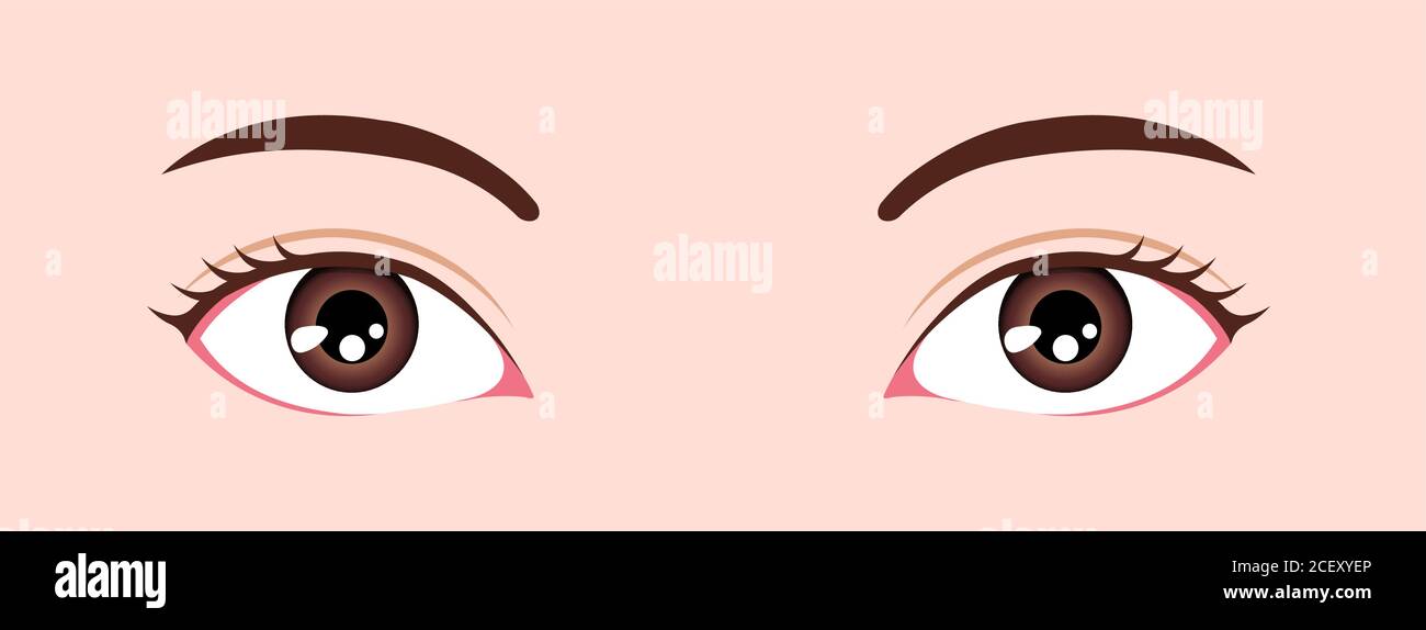 Eye shapes ( eyeball size and position ) vector illustration Stock Vector