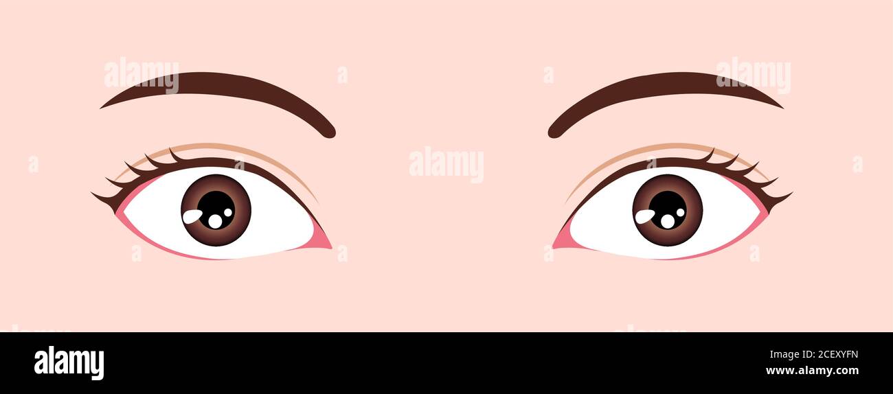 Eye shapes ( eyeball size and position ) vector illustration Stock Vector