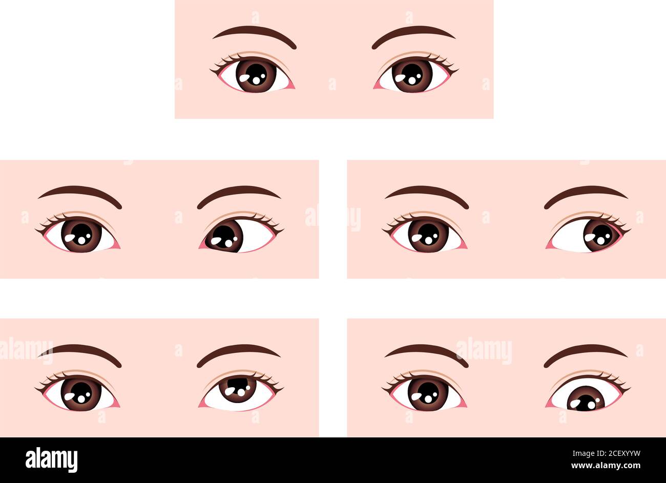 Types of strabismus vector illustration Stock Vector
