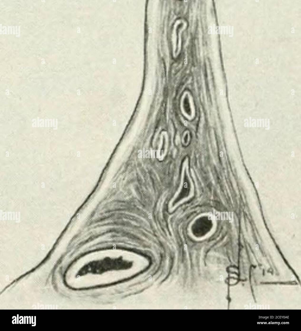 Ovarian artery hi-res stock photography and images - Alamy