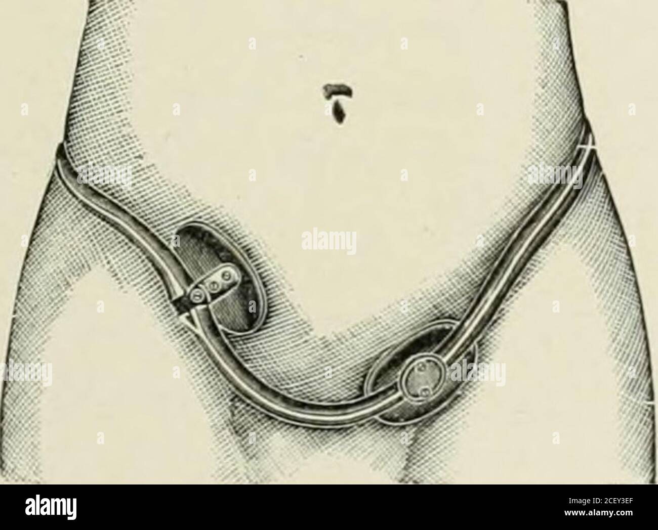 Inguinal hernia truss hi-res stock photography and images - Alamy