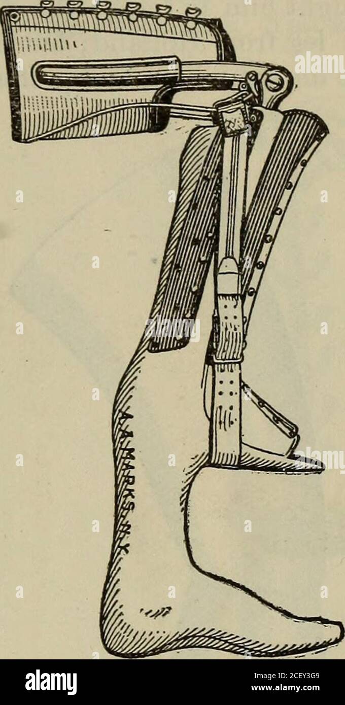 Peg legs hires stock photography and images Alamy