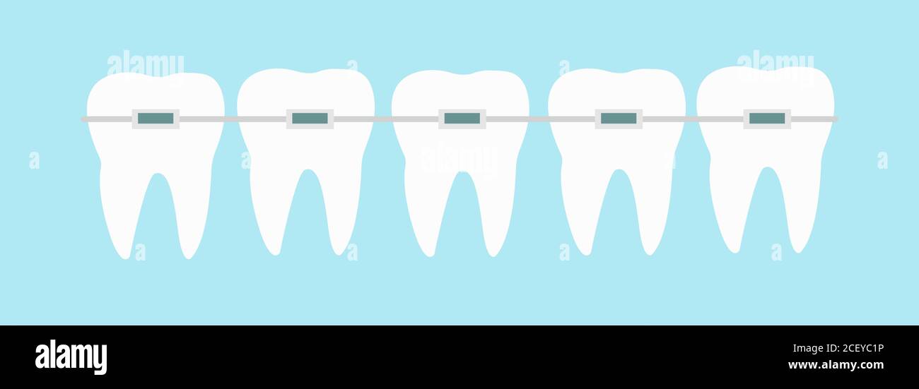 Five teeth with dental braces line on blue background vector