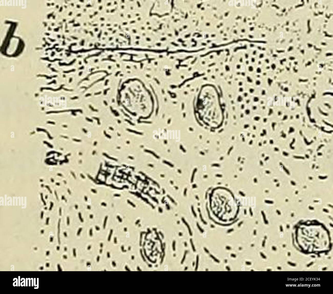Lehrbuch Der Speziellen Pathologischen Anatomie Fur Studierende Und Arzte Nder Gedrangt Und Mehr Und Mehr Zum Schwund Gebracht Werden Alsauch An Die Oberflache Wo Es Sich Als Pseudomembran Grauweisse Odergelbweisse Platte