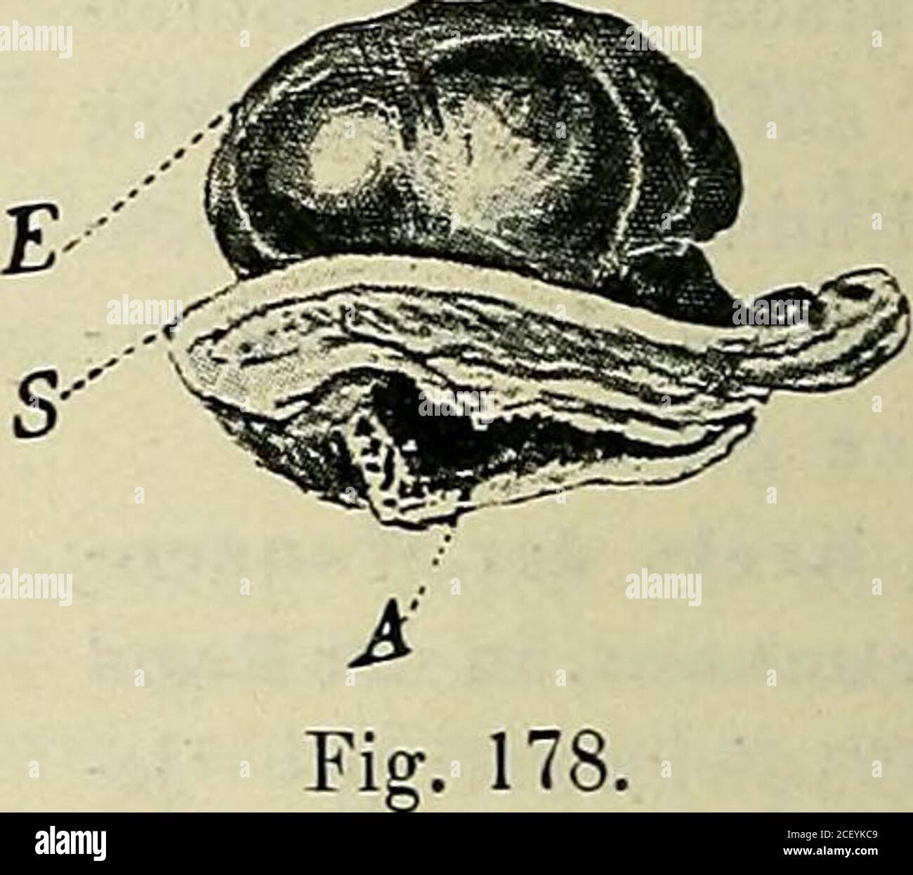 . Lehrbuch der speziellen pathologischen Anatomie für Studierende und
