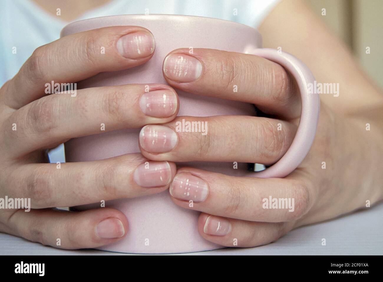 What do healthy nails look like?