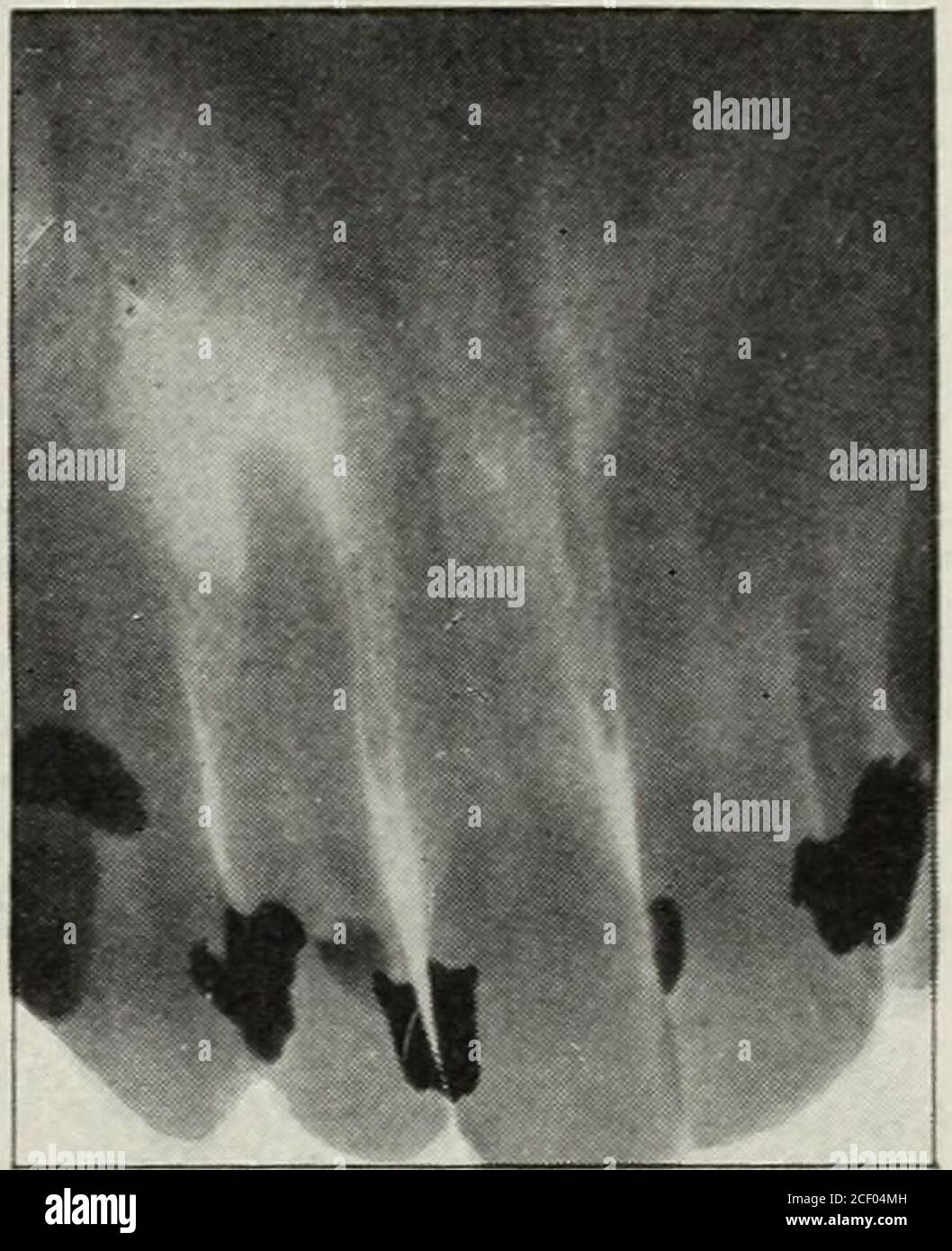 . The Dental cosmos. ft lateral incisor. The slightdiscoloration and ...