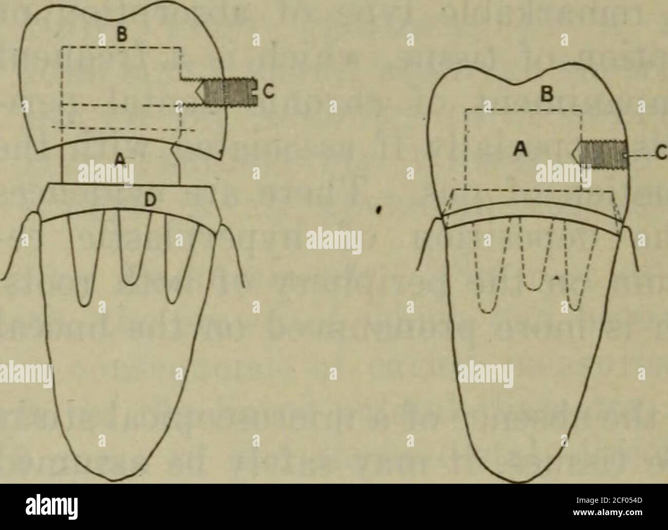 The Dental Cosmos In This Paper It Is My Purpose Todescribe As Briefly As Possible The Con Struction Of A New Efficient And Simpli Fied Method Of Making A Removablecrown It Can Be